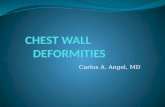 CHEST WALL      DEFORMITIES