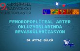 FEMOROPOPLİTEAL ARTER OKLUZYONLARINDA REVASKÜLARİZASYON