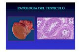 T5 Patología testicular
