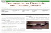 06 Trauma Dental em dentes jovens