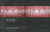 integração entre Dentística e Periodontia