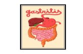 Como Curar La Gastritis Crónica