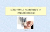 5) implantologie 2014