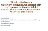Tiroidita Hashimoto – Tratament Acupunctural Selectat Prin Metoda