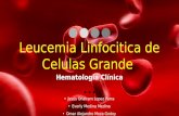Leucemia Linfocitica de Celulas Grandes Granulares