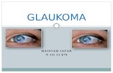 Glaukoma (Dr.frangky)