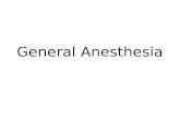 General Anestesia Done