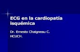 ECG en Cardiopatía Isquémica
