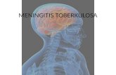 Case Meningitis TB