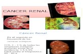 Cancer Renal 1
