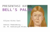 Presentasi Kasus-bells Palsy