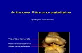 13 Arthrose Fémoro Patellaire