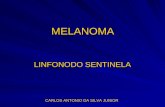 MELANOMA LINFONODO SENTINELA CARLOS ANTONIO DA SILVA JUNIOR.