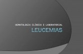 HEMATOLOGIA CLÍNICA E LABORATORIAL. Leucemias – Conceito:  São doenças caracterizadas pelo acúmulo de leucócitos malignos na medula óssea e no sangue.