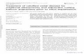 Treatment of calcified ostial disease by rotational atherectomy and adjunctive cutting balloon angioplasty prior to stent implantation