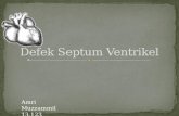 Defek Septum Ventrikel