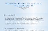 Sk9_Sirosis Hati et causa Hepatitis B.pptx