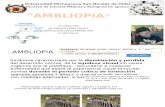 Ambliopia OFTALMO
