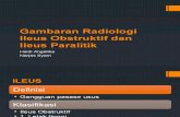 Gambaran Radiologi Ileus Obstruktif dan Ileus Paralitik.pptx