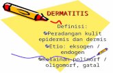 Dermatitis sssssssssstiss