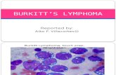 Burkitt s Lymphoma
