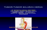 Tumor-tumor Saluran Cerna