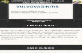 Vulvovaginitis Exp