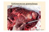 Echinococcus granulosus [Modo de compatibilidad].pdf