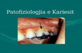 Pathophysiology of Dental Caries