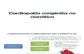 Cardiopatía congénita no cianótica