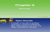 CH09 Wounds