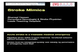 Dr Ahamad Hassan Stroke Mimics