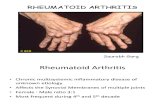 Rhumatoid Arthtritis