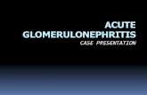 Psgn _acute Glomerulonephritis