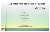 Gambaran Radiologi Gout Artritis