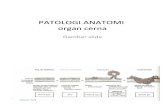 Patologi Anatomi Slide