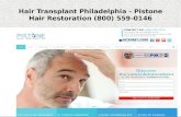 Hair Transplant Cost Philadelphia