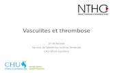 Vasculites et thrombose
