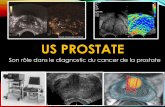 Us prostate-VAN NIEUWENHOVE