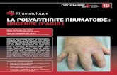 DÉCEMBRE 2014 La polyarthrite rhumatoïde : urgence d'agir