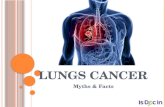 Lungs cancer myths & facts