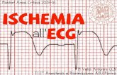 Ecg - ischemia