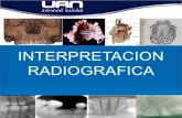 Exp. interpretacion radiografica