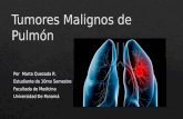 Tumores malignos de pulmón