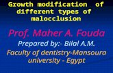 Growth modification  of different types of  malocclusion