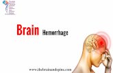 Brain Hemorrhage Treatment In Uttar Pradesh | Best Neurologist In India