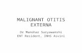 Malignant otitis externa