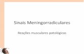 Sinais meningorradiculares