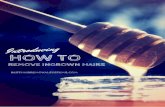 How to remove ingrown hairs