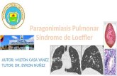 Paragonimiasis Pulmonar -  Síndrome de Loeffler